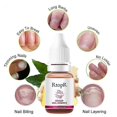 thumbnail image 4 of 5pcs Ginger Nail Essence Gray Nail Moisturizing Care Exfoliating Anti Paronychia Thicken Crack Nail Fungal Nail Treatment Essence Hand Foot, 4 of 5