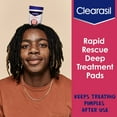 Clearasil Rapid Rescue Deep Treatment Acne Face Pads, Maximum Strenght