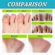 thumbnail image 5 of 1/2/3pcs Foot And Nail Spary, Natural And Powerful Foot Care, 5 of 5