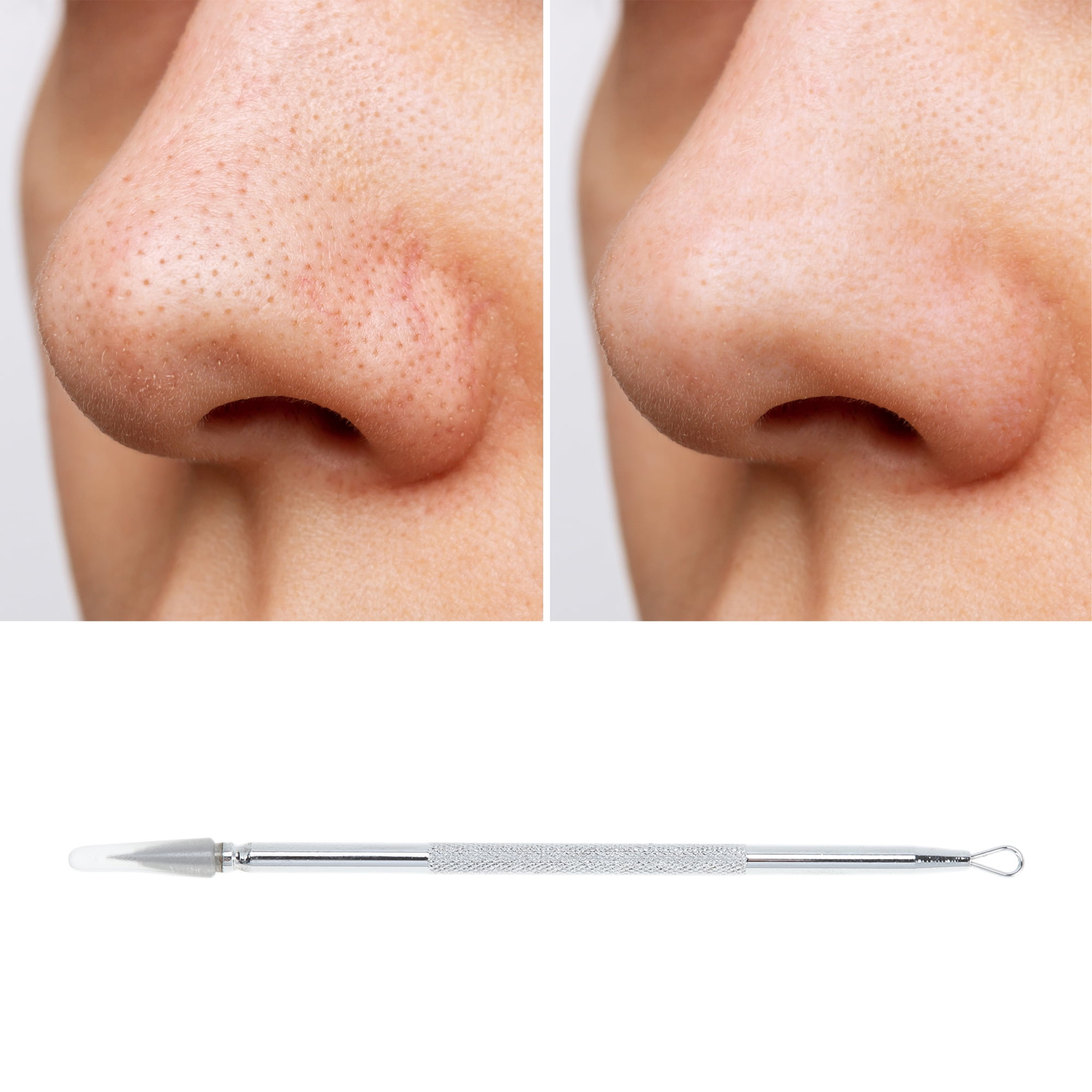 Unique Bargains 1pc Facial Double-Headed Pimple Extractor Tool for Skin Care Silver Tone