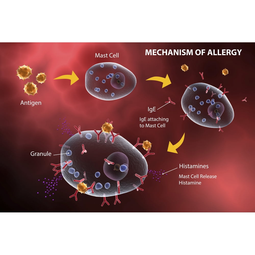 Mast cell releasing histamine due to allergic reaction Poster Print (17