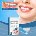 thumbnail image 2 of Teeth Whitening Kit - Stain Removal, Disposable Sponges, for Oral Care, 2 of 8