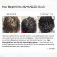 thumbnail image 6 of Serovital Hair Regeneres Advanced – Helps Reduce Hair Breakage & Shedding – Supports Scalp Health – Includes Ashwagandha and Marine Collagen, 6 of 11
