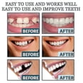 thumbnail image 3 of Adjustable Snap-on Dentures Cosmetic Teeth InterBraces Orthodontic De, 3 of 5