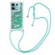 thumbnail image 1 of Funda FOXDOCK para Xiaomi Redmi Note 13 5G con Cuerda Ajustable, Brillo Líquido, Protección Antigolpes y Lente – Ideal para Regalo, 1 of 6