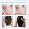 thumbnail image 4 of Varita de alta frecuencia DermatiPrem, 4 of 5