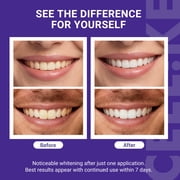CEELIKE Teeth Whitening Strips (7 Treatments/14 Strips) - Peroxide-Free Whitening Kit with Hydroxyapatite, Enamel Safe + Cheek Retractor, Easy 3-Step at-Home Teeth Whitening for Deep Stain Removal