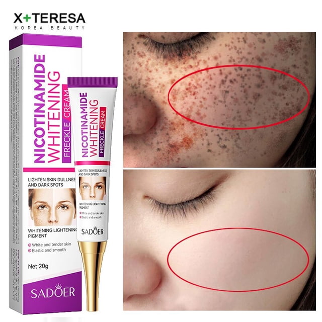 Crema para eliminar pecas, reduce las manchas de la edad, desvanece las manchas oscuras, crema blanqueadora de la piel, tratamiento de manchas, crema facial, 30g"02" Fivean LED