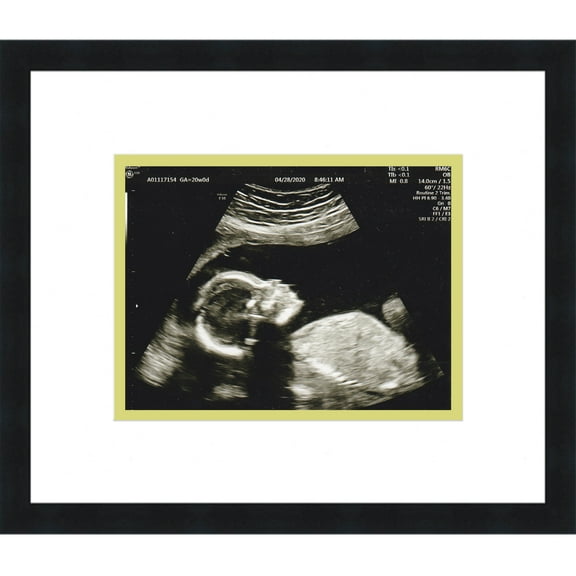 6x5 Black Sonogram Frame with White on Green Mats with 1 Opening to Display 1 4x3 Sonogram - with