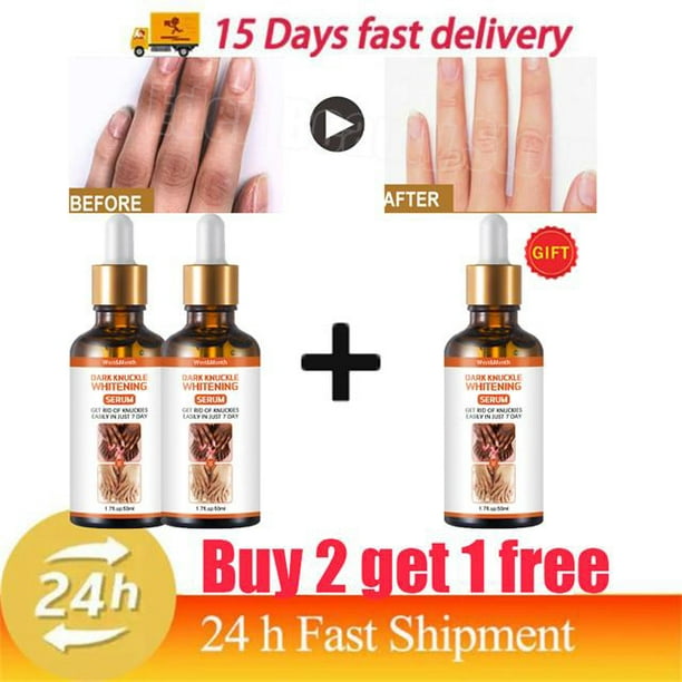Suero blanqueador rápido para nudillos oscuros, Corrector de melanina para nudillos de manos, producto eliminador de manchas intensas para el cuidado de la piel negra, 50ml