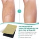 thumbnail image 2 of Leg Varicose Vein Repair Patch Professional Earthworm Leg Care Safety Stickers, 2 of 4