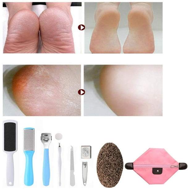 Pedicure Kit Spa Home Pedicure Kit 10 in 1 Stainless Steel Foot Scrubber Tool Foot Rasp