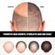 thumbnail image 4 of Sérum para el crecimiento del cabello fino con ampolla anticaída y potenciador del brillo para mujeres., 4 of 5