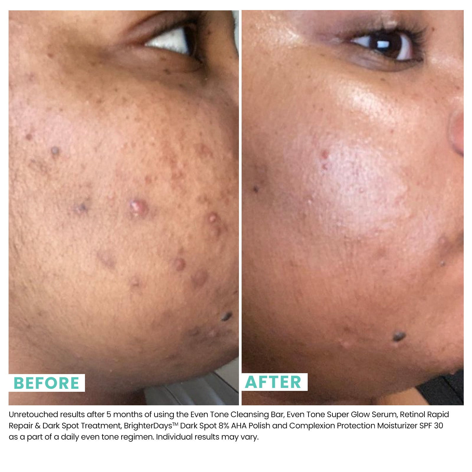 Even Tone Super Glow Serum .5 FL OZ