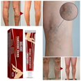 thumbnail image 1 of Crema para tratamiento de venas varicosas, vasculitis, flebitis, eliminación del dolor en las piernas de araña, 1 of 5
