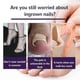 thumbnail image 5 of EELHOE 50Pcs Elastic Ingrown Toenail Correction Stickers Elastic Adhesive Relieve Feet Pain More A, 5 of 5