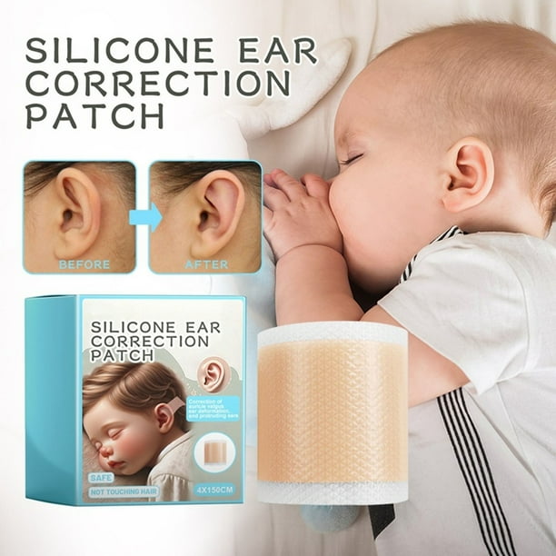 Cinta correctora de orejas suave y transpirable para bebés, parche corrector de valgo de oreja para bebés, herramientas para corrección de orejas de bebés, parche corrector