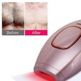 thumbnail image 2 of Depiladora láser de depilación IPL Electric Razors 300000 Flas, 2 of 5