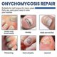 thumbnail image 2 of Nail Repairing Mask Soft Nail Inlay Thickened Bright Nail Groove Gray Nail Nursing Adhe, 2 of 4