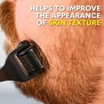 thumbnail image 4 of Derma Roller Beard Club para rostro, cuerpo y cuero cabelludo 540 agujas, 4 of 9