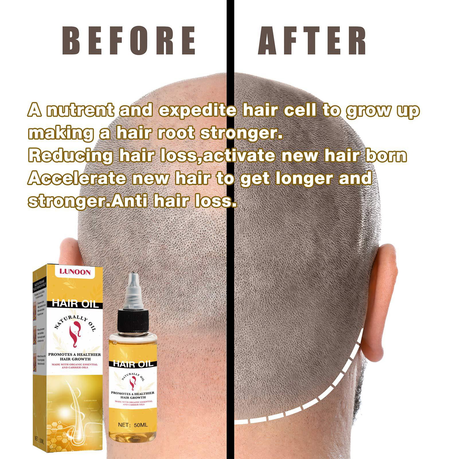 Buy En vee grow up plus hair oil 120ml Online at Low Prices in India -  Amazon.in