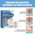thumbnail image 3 of 32 Pcs Toenail Fungus Treatment, Nail Repair Patches , Foot Patch, Treatment For Restores Damaged Nails And Appearance Of Discolored, 3 of 5