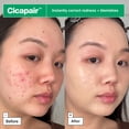 thumbnail image 4 of Crema CC Cream Dr.Jart+ Cicapair Soothing SPF30 55 ml para el cuidado de la rosácea, 4 of 8