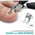 thumbnail image 2 of RONAVO Toenail Clippers for Thick Nails - Nail Clippers Set for Men.Heavy Duty Professional Thick & Ingrown Toe Nail Clipper, Large Toenail Scissors for Elderly/Mens/Women,Long Handle Safety (B, 2 of 9