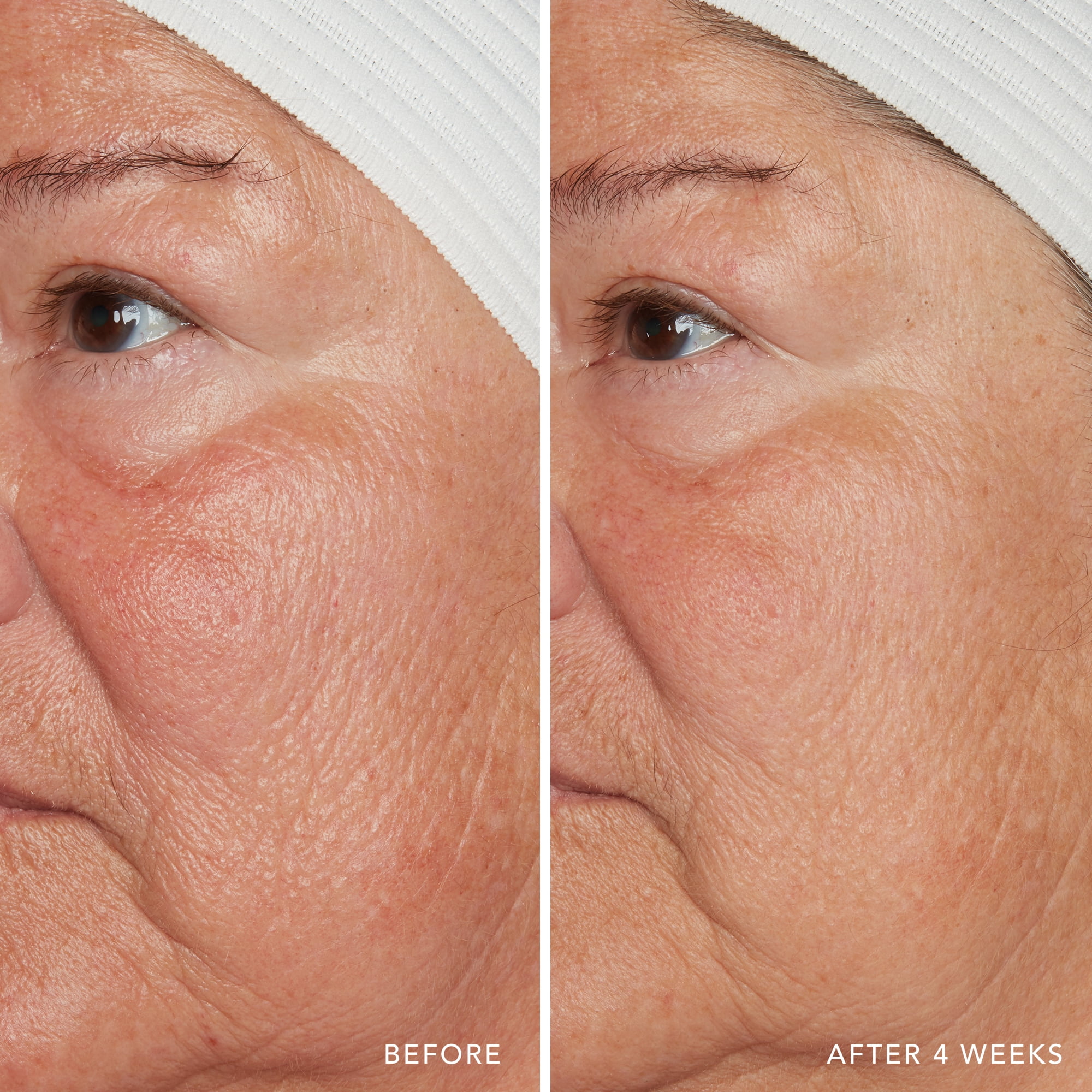 REDNESS RELIEF INTENSE WITH MANUKA HONEY