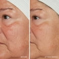 thumbnail image 3 of REDNESS RELIEF INTENSE WITH MANUKA HONEY, 3 of 8