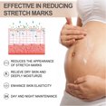 thumbnail image 3 of Stretch Marks Cream, Pregnancy Skin Care Cream Nourishing  for Belly Legs, 3 of 7