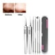 thumbnail image 5 of Xihbxyly Kit de Eliminación de Puntos Negros, Extractores Profesionales de Acero Inoxidable, Mango Antideslizante, Estuche Portátil, Rutina de Cuidado de La Piel, Artículos Esenciales de Belleza para, 5 of 6