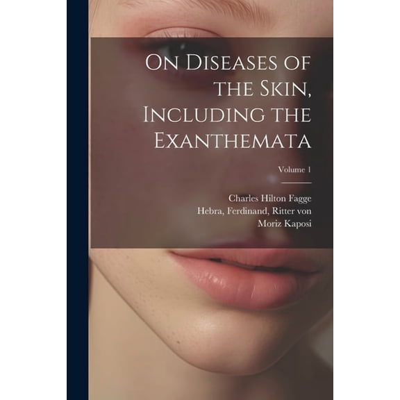 On Diseases of the Skin, Including the Exanthemata; Volume 1 (Paperback)