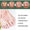 thumbnail image 4 of Nail Fungus Treatment, 50ml Toenail Fungus Treatment, Extra Strong Nail Repair Solution with Natural Tea Tre, 4 of 5