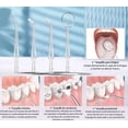 thumbnail image 4 of Irrigadores Bucales Orales Qa-001 Limpiador Eléctrico Rociador De Agua Dental Recargable 220ml 3 Modos 120psi Impermeable, 4 of 4