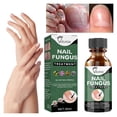 thumbnail image 2 of Líquido reparador de uñas extra fuerte, solución para uñas de pies y manos, para uñas dañadas y descoloridas, 50 ml, 2 of 8