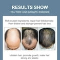 thumbnail image 6 of 2 Pack Tea Tree Essential Oil - Organic Drops for Skin, Face, Hair, Scalp, Nails - Fragrance Oil for Aromatherapy, Diffusers, 6 of 7