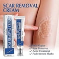 thumbnail image 3 of Acnes Scars Removal Cream Effectiveness Non-irritating Cream For Face, 3 of 5