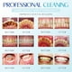thumbnail image 5 of Fiudx Kit de Higiene Dental, Pinzas de Acero Inoxidable, Espejo Bucal Iluminado, Ayuda para Eliminar Restos de Comida, Inspección de Higiene Bucal, para Adultos, Estuche Compacto., 5 of 6
