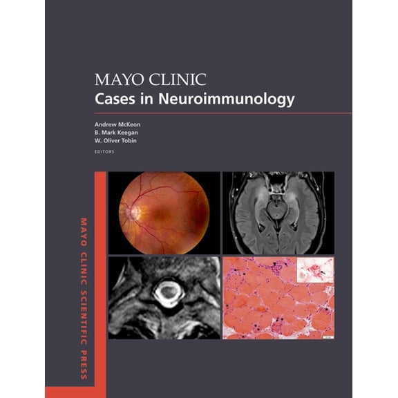 Mayo Clinic Scientific Press Mayo Clinic Cases in Neuroimmunology, (Paperback)