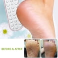 thumbnail image 4 of Lima para pies, removedor de vello de pies de doble cara, exfoliante de tratamiento para pies de acero inoxidable, 4 of 6