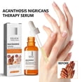 thumbnail image 2 of Suero Blanqueador para Cuerpo, Rostro, Cuello, Crema Blanqueadora Natural para Axilas Crema Blanqueadora para Axilas, Rodillas, Codos, Partes Privadas 30 Ml, 2 of 5