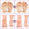 thumbnail image 5 of Foot Scraper Pedicure Kit，Callus Remover For Feet Hard Skin Shaver Premium Foot Care Supplies - rose gold, 5 of 5