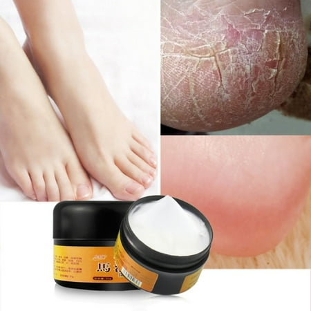 Horse Oil Foot Cream Anti-Chapping Skin Repairing Moisturizer For Rough Dry And Cracked Chapped Feet
