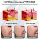 thumbnail image 2 of mole spot removal for flawless makeup, 2 of 5