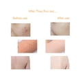 thumbnail image 2 of Jabón Cúrcuma Ácido Removedor Manchas Oscuras Barras Jabón 100 G para Hombres Y Mujeres Tipo Piel, 2 of 9