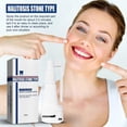 thumbnail image 4 of Tartar dissolving oral spray lasting fragrance dissolves tartar and bad breath, 4 of 5
