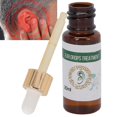 Ear Care Drops Relieve Tinnitus Improve Ear Itching Pain Ear Treatment ...