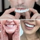 thumbnail image 4 of Fundas dentales postizas Smile Dental Perfect Smile Carillas Comfort Fit Flex Dentadura postiza, 4 of 5