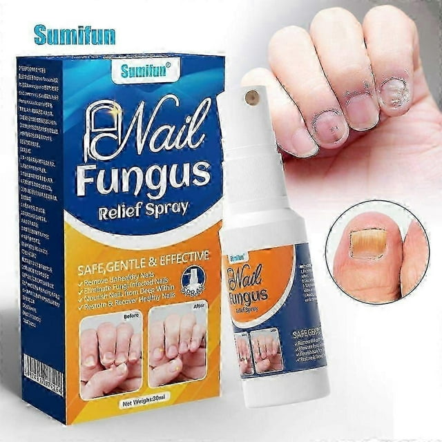 Effective Solution for Nail Fungus on Hands & Feet, Repairs Discolored Nails, Shields Thick or Damaged Nails